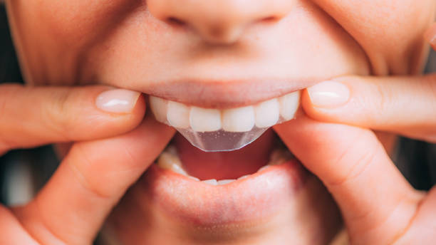 a person applying a teeth whitening strip