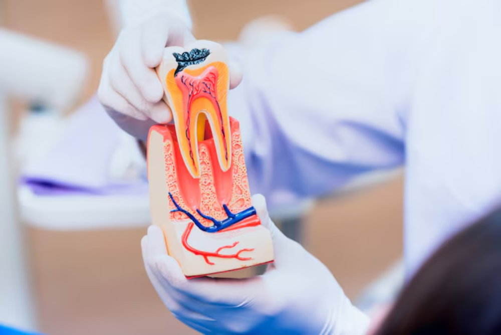 Root canal therapy in Vinings helps stop infection and maintain tooth structure. Choose experienced root canal therapy near you for safe care.